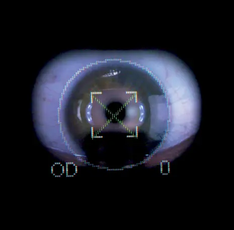 TonoCare 2.0 - Image 5