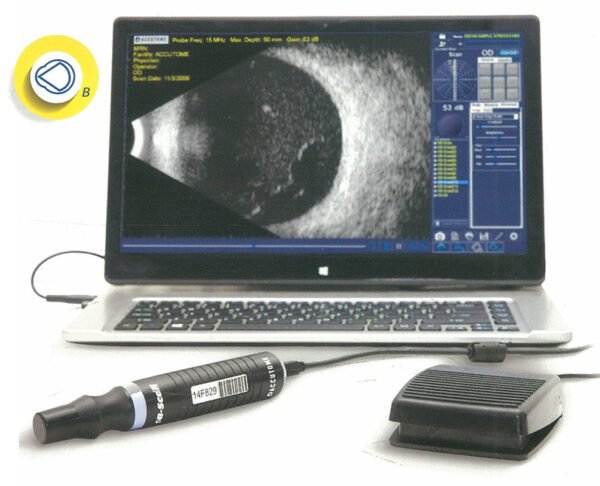 KEELER ACCUTOME B SCAN PLUS WITH LAPTOP