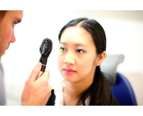 Keeler 3.6V chargeable professional Ophthalmoscope Halogen with Charger set - Image 5